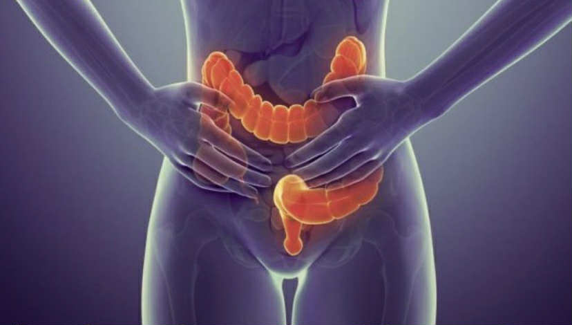 Kanceri i zorrës së trashë po kërcënon gjithnjë e më shumë të rinjtë, ja kujdesi që duhet të tregoni